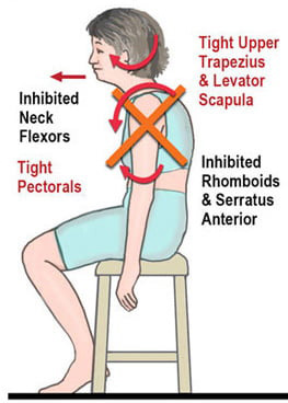 diagram of tension headaches due to poor posture