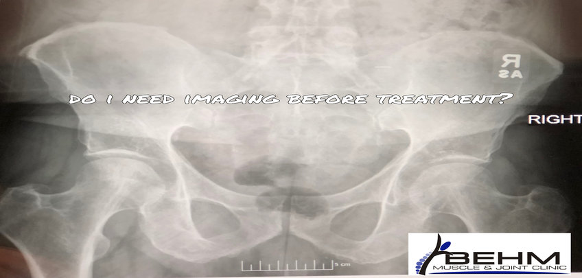 x-rays-before-treatment
