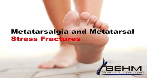 Metatarsal Stress Fractures