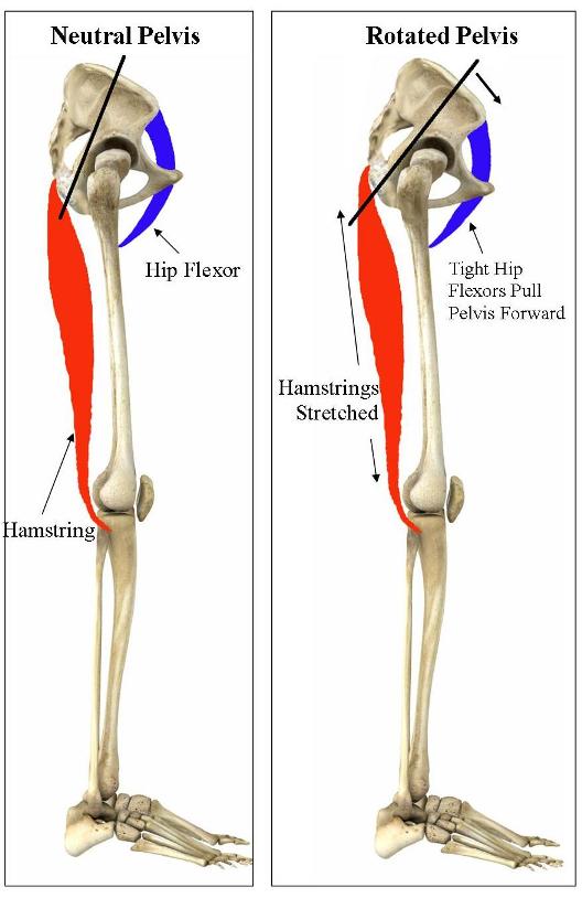 Traction techniques elbow and pelvis