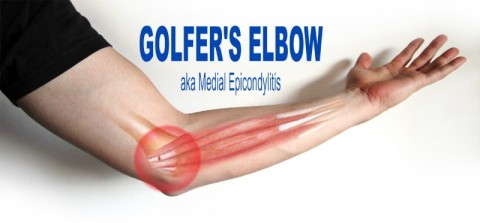 Golfer’s Elbow AKA Medial Epicondylitis
