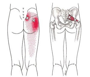 trigger point pain pattern of the piriformis
