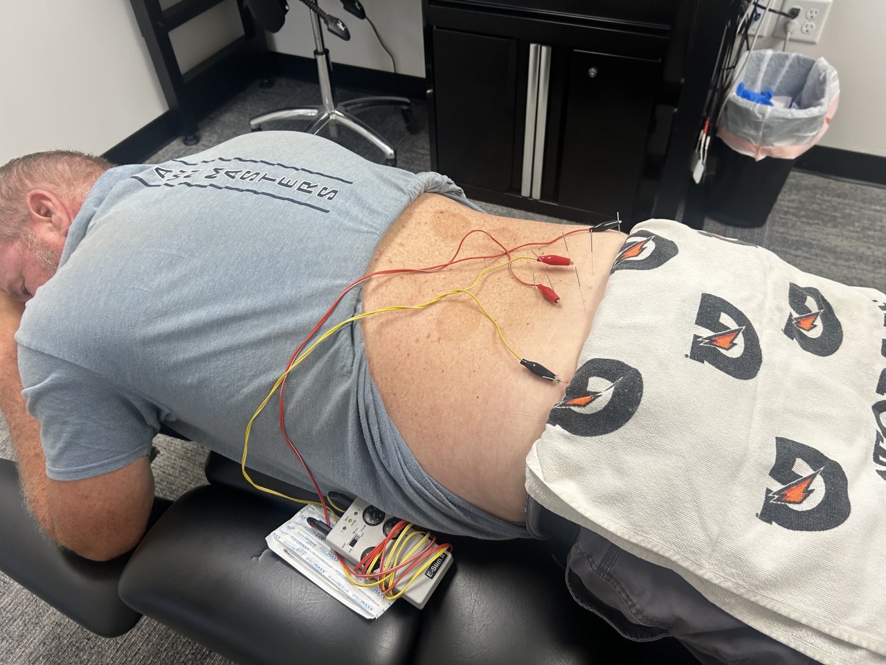 dry needling with electrical stimulation Bellevue Nebraska