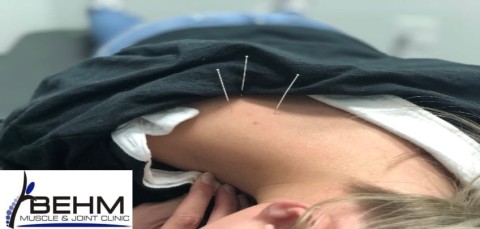 Is Dry Needling the Same as Acupuncture?