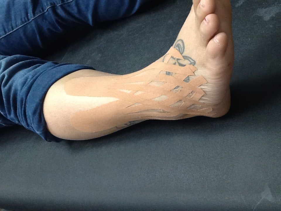 sprained ankle treated with rocktape