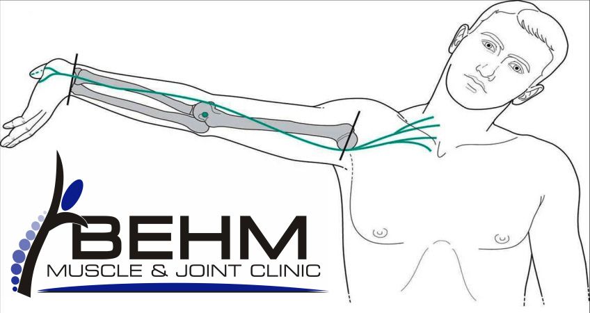 nerve graphics showing Neuromobilization technique